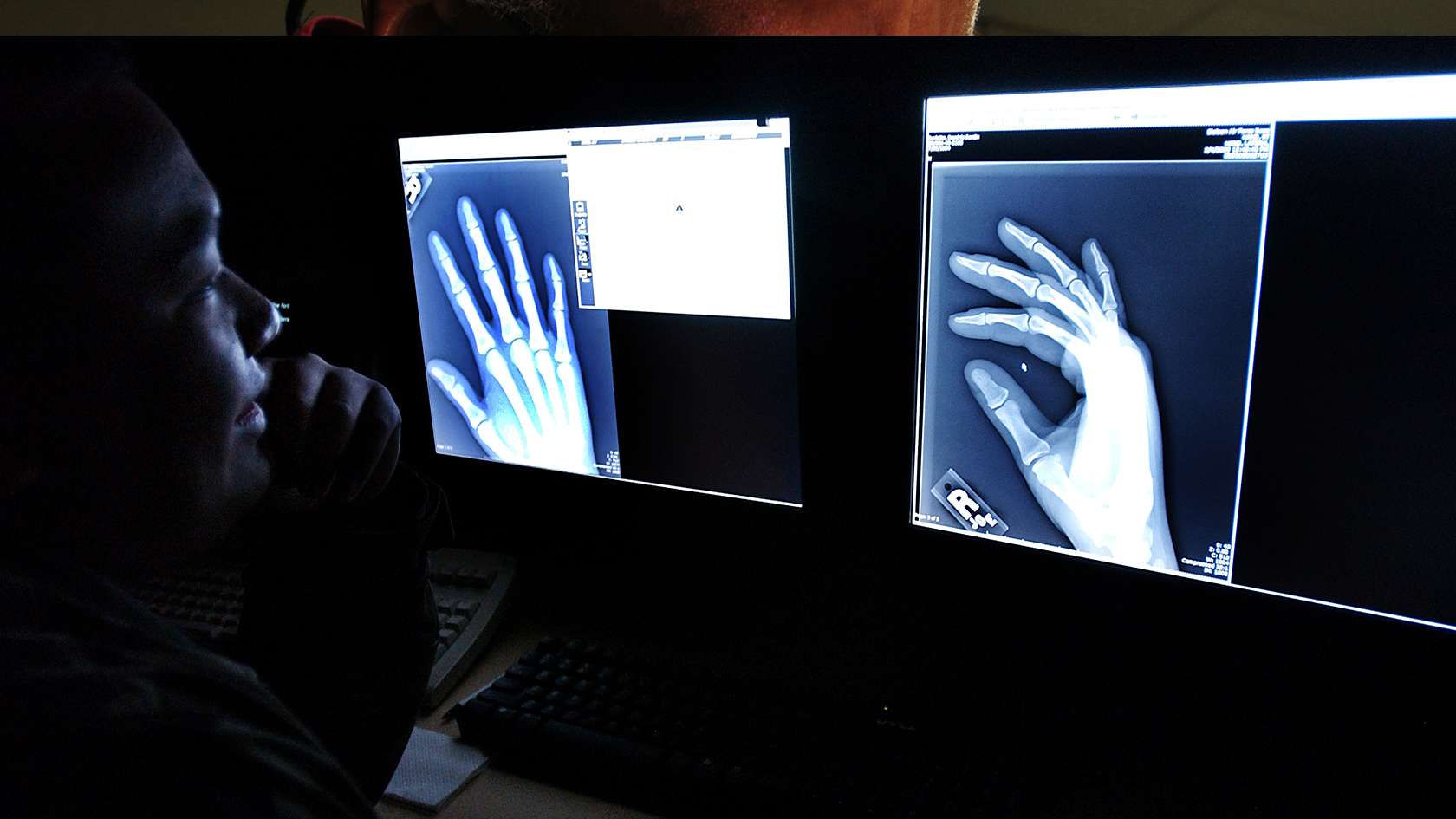 Diagnostic Radiologist looking at x-rays on monitor